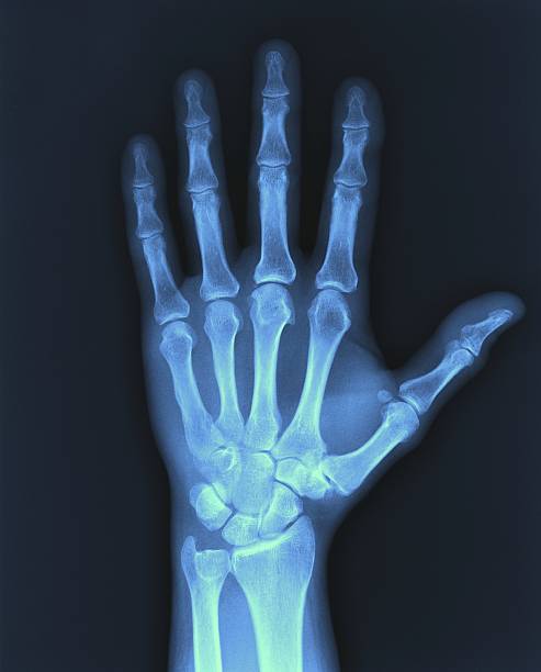 Technologist positioning patient for X-ray